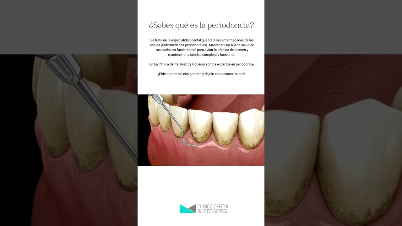 ¿Sabes qué es la periodoncia?