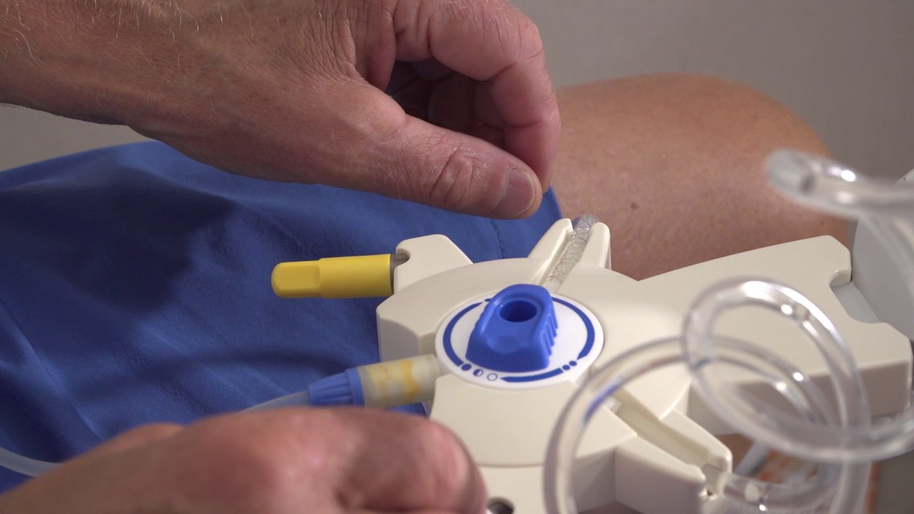 Instructie: hoe werkt peritoneale dialyse
