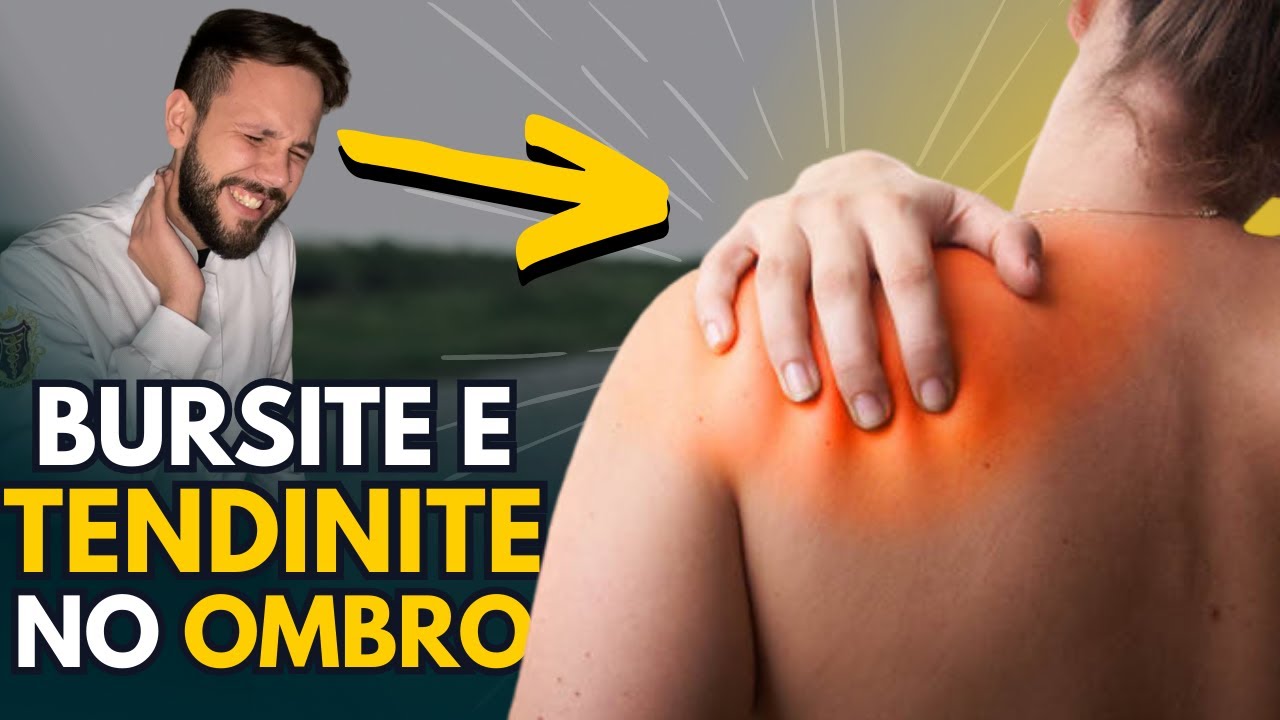 COMO TRATAR A BURSITE E TENDINITE NO OMBRO?