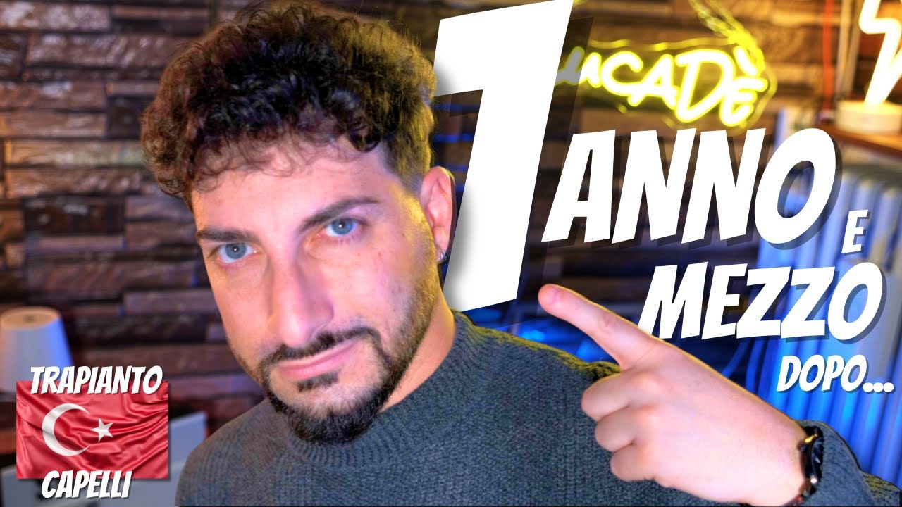Trapianto di Capelli 1 anno e mezzo dopo, Turchia da Serkan