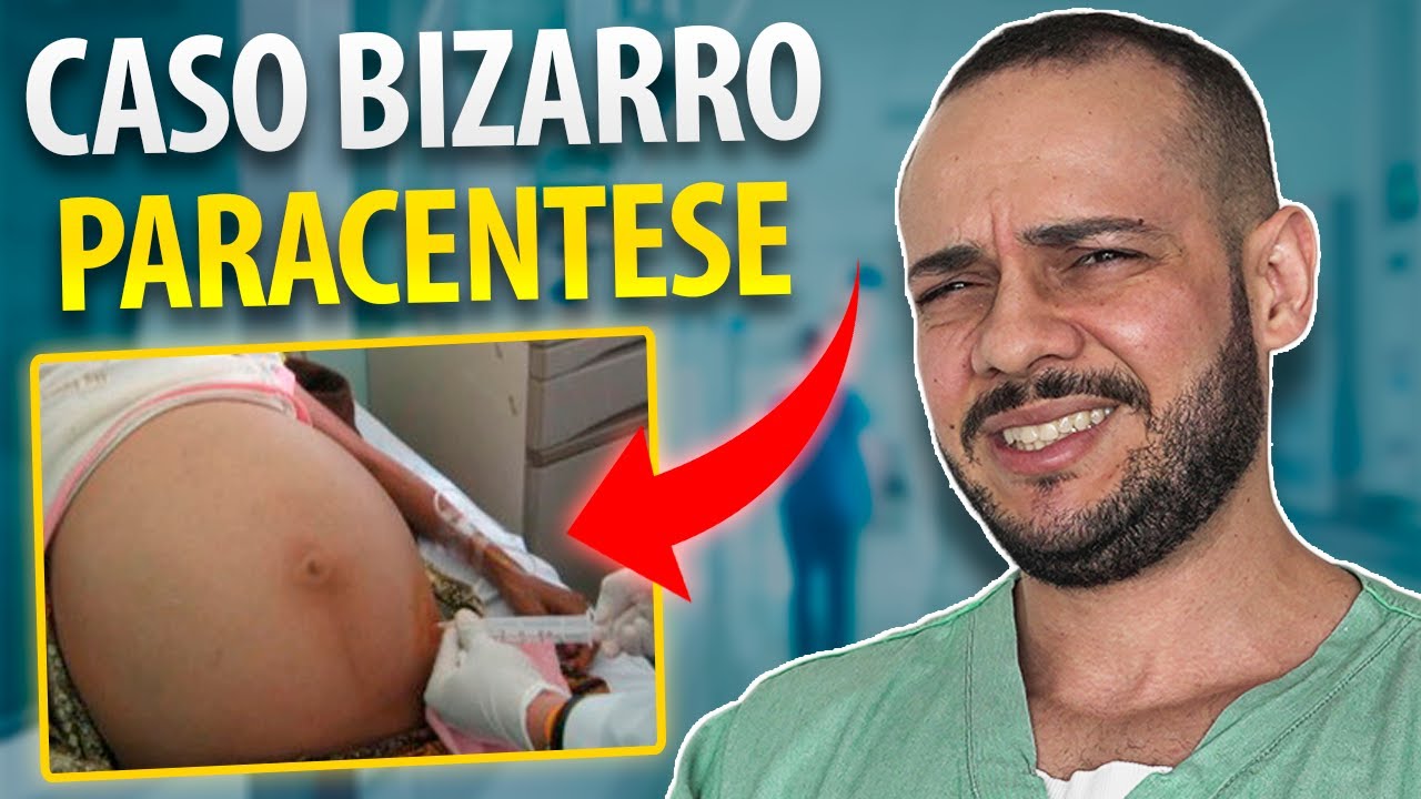 Caso bizarro! Paracentese salvou a vida desse paciente!!