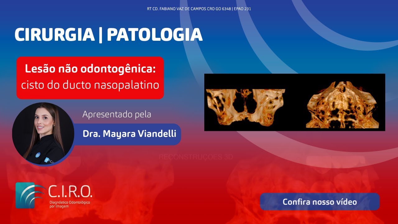 Lesão não odontogênica: cisto do ducto nasopalatino | Caso Clínico com a Dra. Mayara Viandelli
