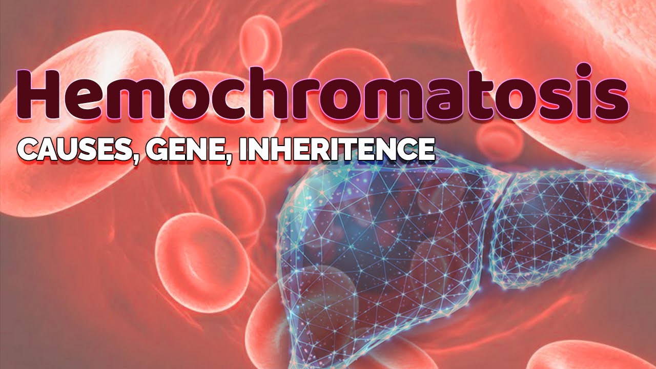 Hemochromatosis - Cause, Gene & Inheritance | HFE gene |  Iron storage in Liver | Transferrin