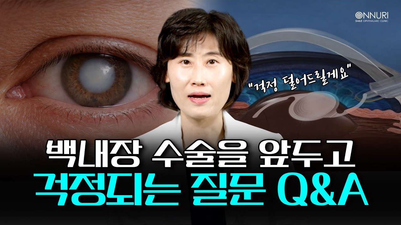 백내장 수술 전 가장 많이 받는 질문🤔
