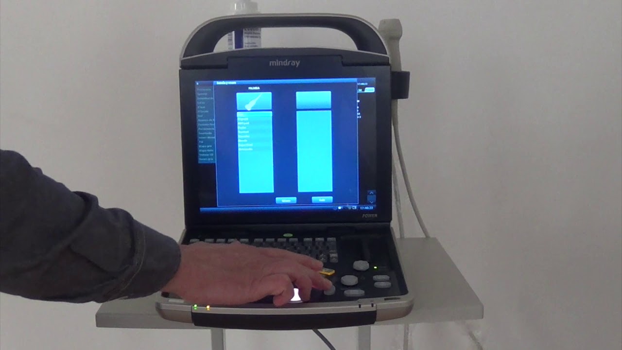 Ecógrafo Mindray DP30