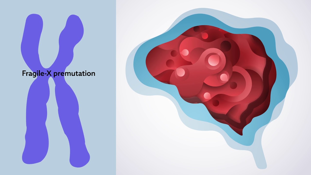 Understanding neurodevelopmental disorders and the people they affect
