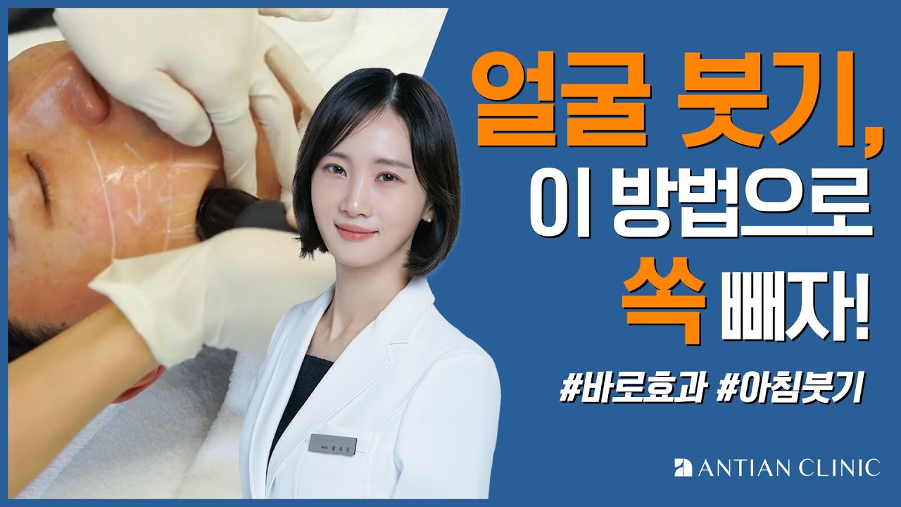 아침에 부은얼굴 5분만에 바로 빼는 방법, 얼굴 붓기와 이중턱이 스트레스라면 이 영상 무조건 보세요👀ㅣ 얼굴 부종 /  이중턱 / 얼굴붓기 빠르게 빼는 방법ㅣDr.왕수진