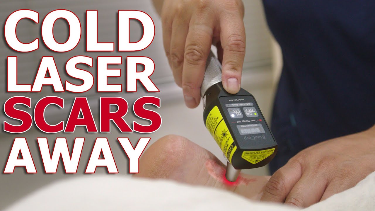 Cold Laser/Low-Level Laser Treatment | Reduce Scar Appearance And Swelling