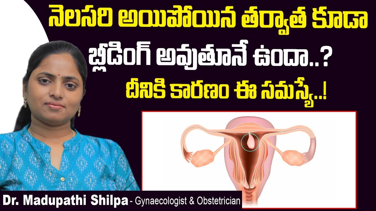 ఎండోమెట్రియల్ పాలిప్ అంటే | Symptoms and Treatment of Endometrial Polyps | Dr Shilpa Women's Clinic