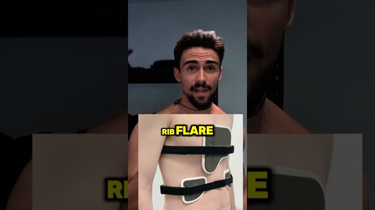 Do Braces Work For Pectus Carinatum & Rib Flare