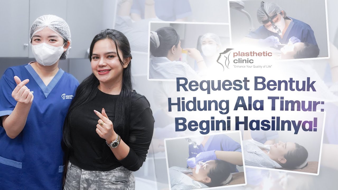 Operasi Hidung Dengan Tulang Rawan Iga I Honest Review ✨