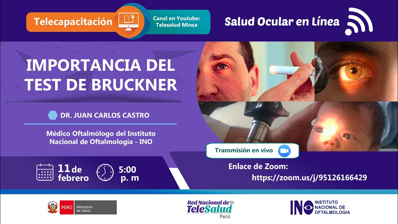 CLAVES Y ESTUDIO DEL EXAMEN DE REFLEJO DE OJOS - TEST DE BRUCKNER