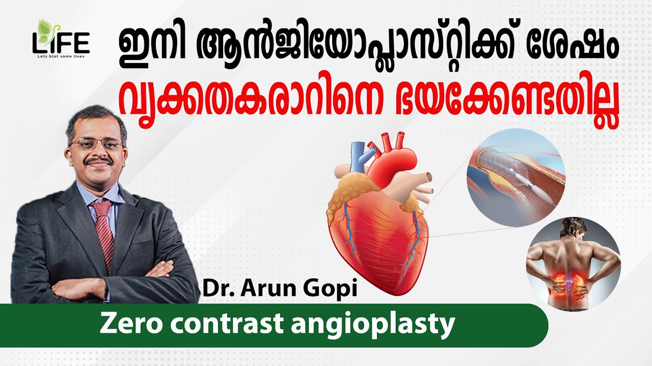 എന്താണ് സീറോ കോൺട്രാസ്റ്റ് ആൻജിയോപ്ലാസ്റ്റി? | Dr. Arun Gopi | What is zero contrast angioplasty |