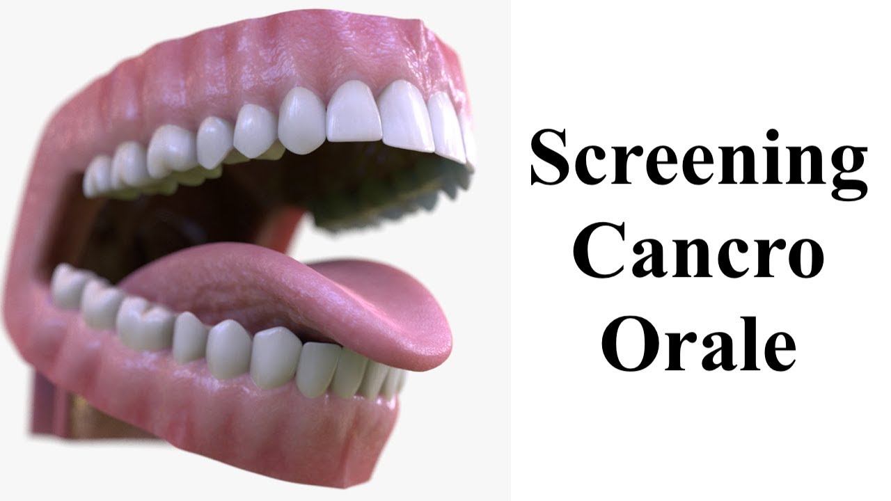Screening cancro orale - Oral Cancer Screening