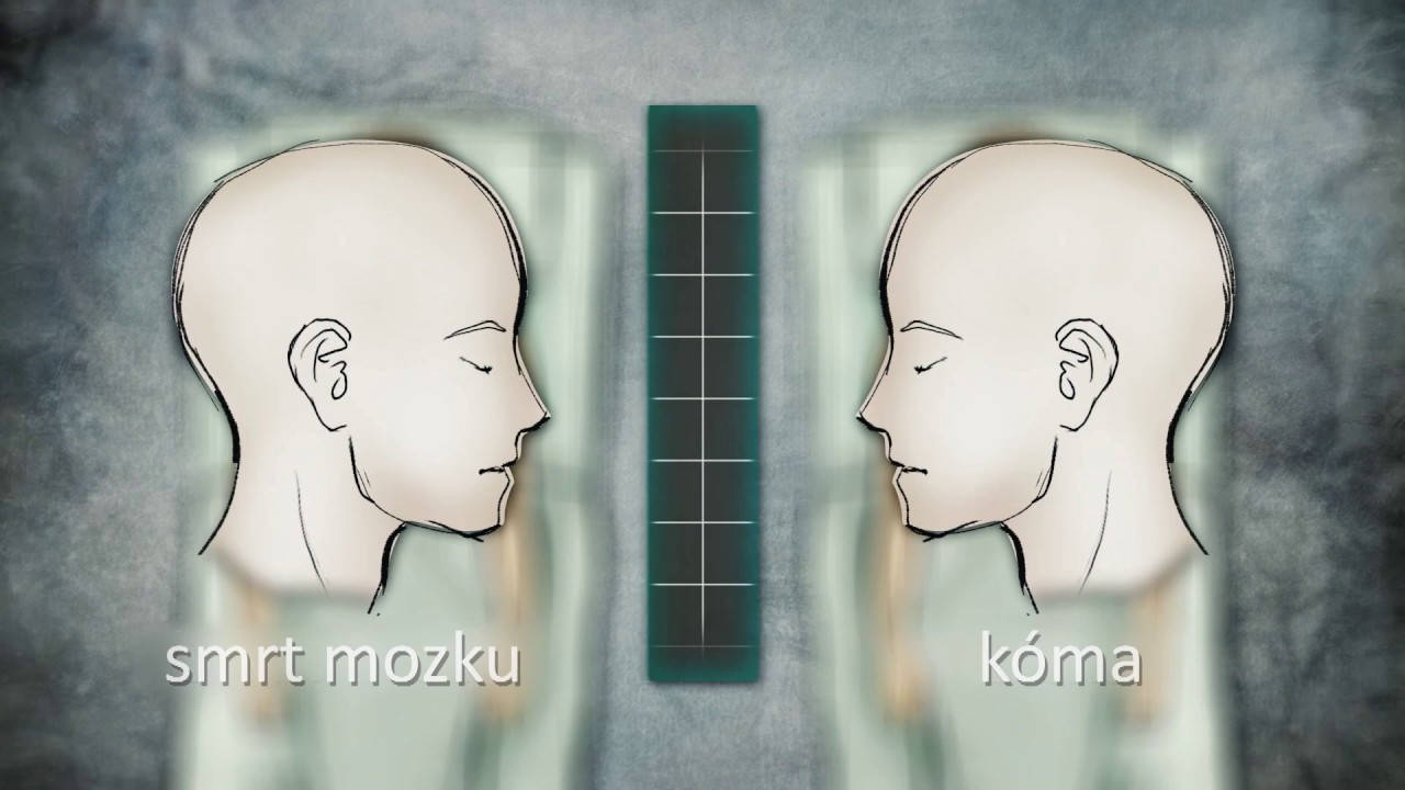 Smrt mozku