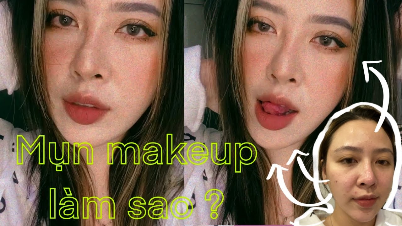 trang điểm KHÔNG KEM NỀN cho DA MỤN   NỀN KHÔNG CAKEY