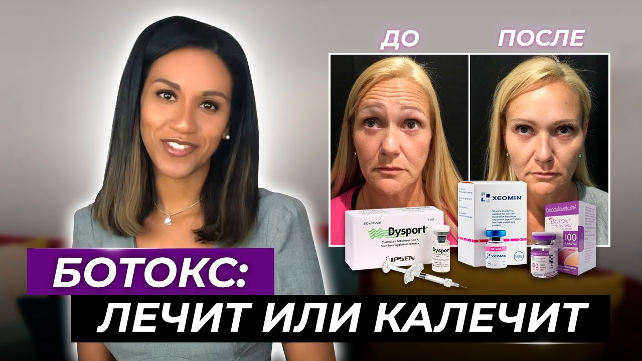BOTOX //Как убрать морщины лба, морщины межбровья и 