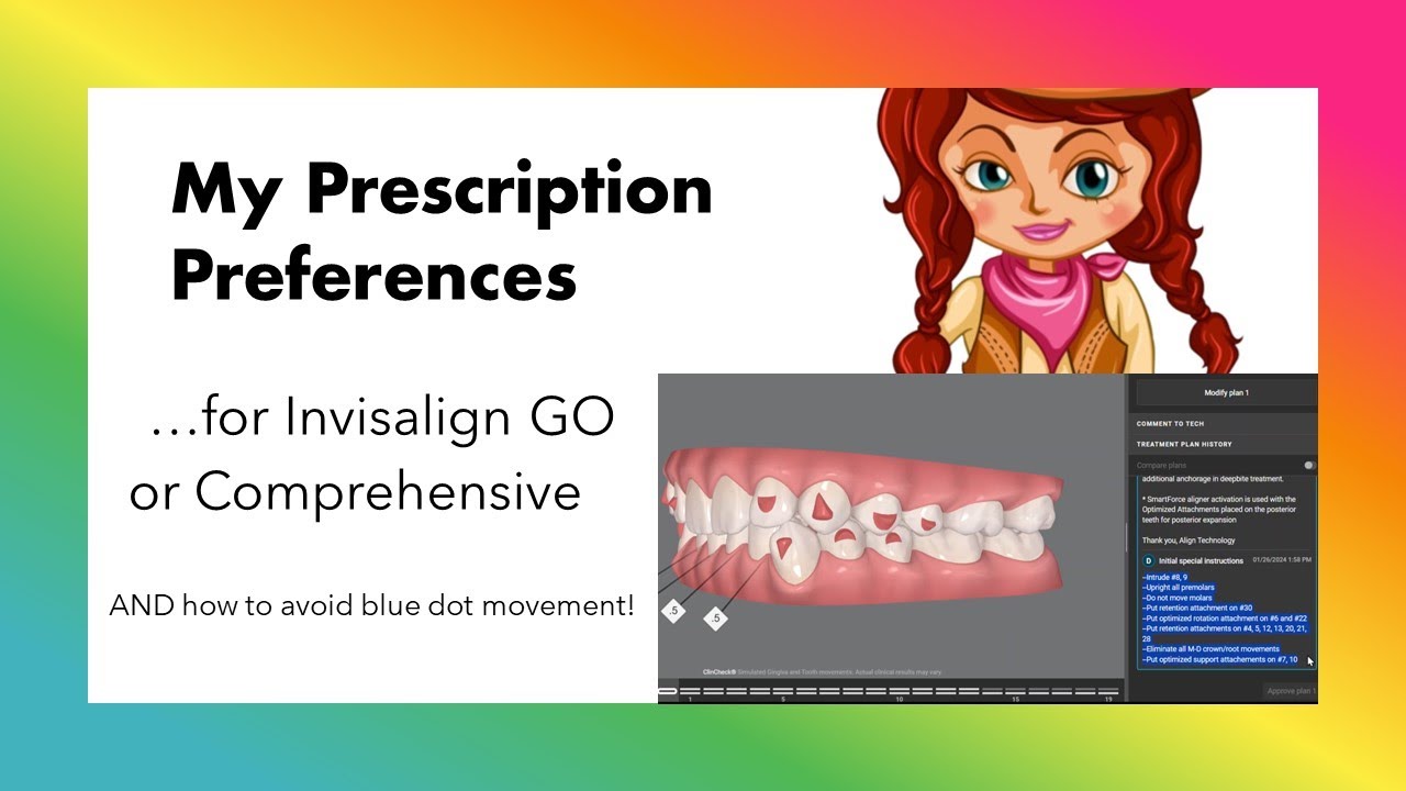 Invisalign ClinCheck - A quick view of my preferences!