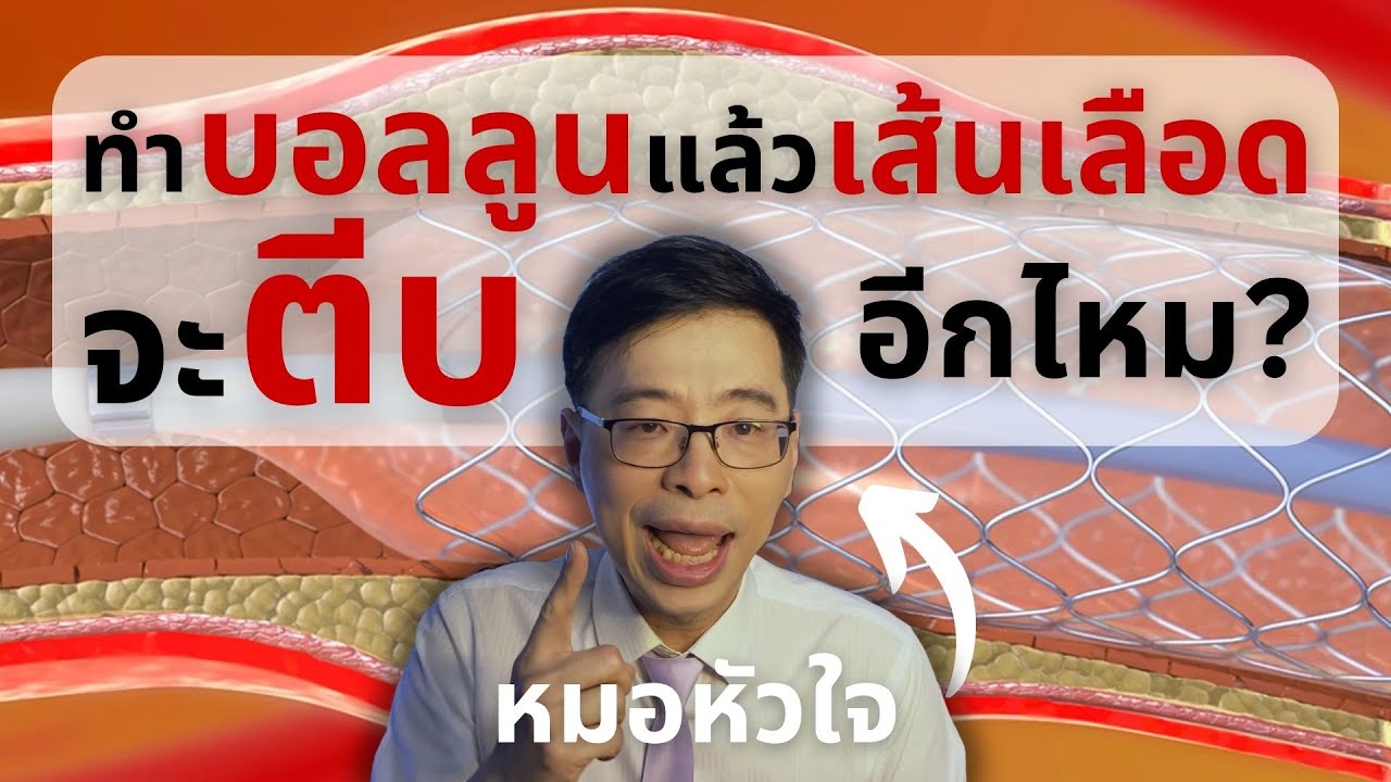 ทำบอลลูนแล้วเส้นเลือดจะตีบอีกไหม? แล้วต้องทำอย่างไร?