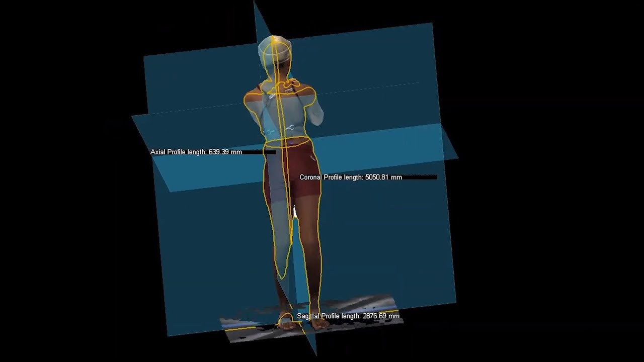Revolutionizing Scoliosis Imaging Without Ionizing Radiation