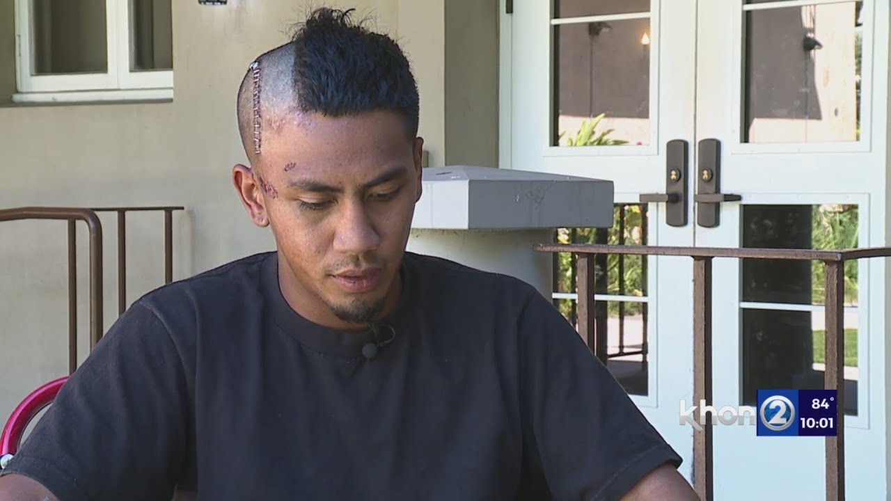 ‘I’m just grateful that I’m here,’ Victim of baseball bat attack in Hilo shares his story