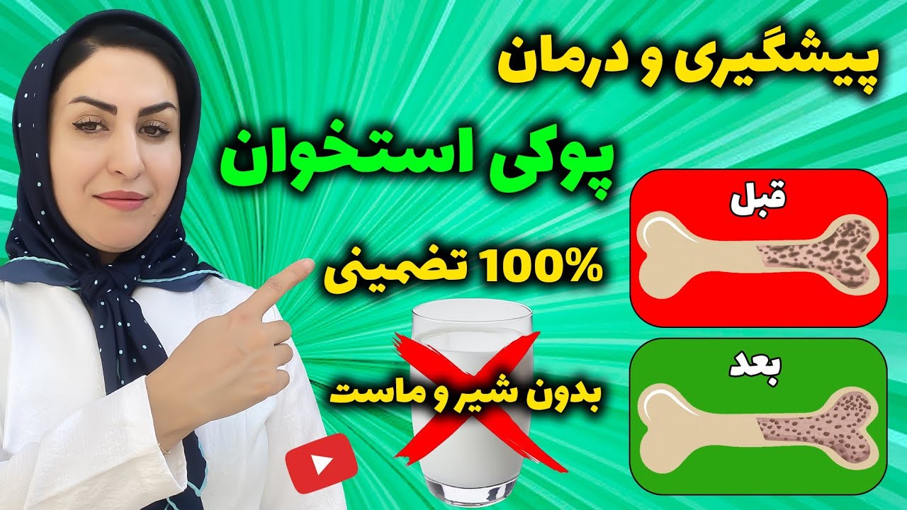 با این 10 خوراکی روند پوکی استخوان را در 60 سالگی معکوس کنید! 😯 | درمان پوکی استخوان 100% تضمینی