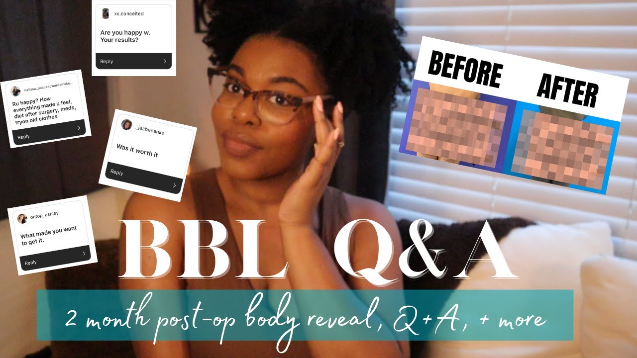 BBL Q&A | 2 MONTH POST OP + BBL BODY REVEAL + BBL BEFORE AND AFTER + BBL POST OP RESULTS