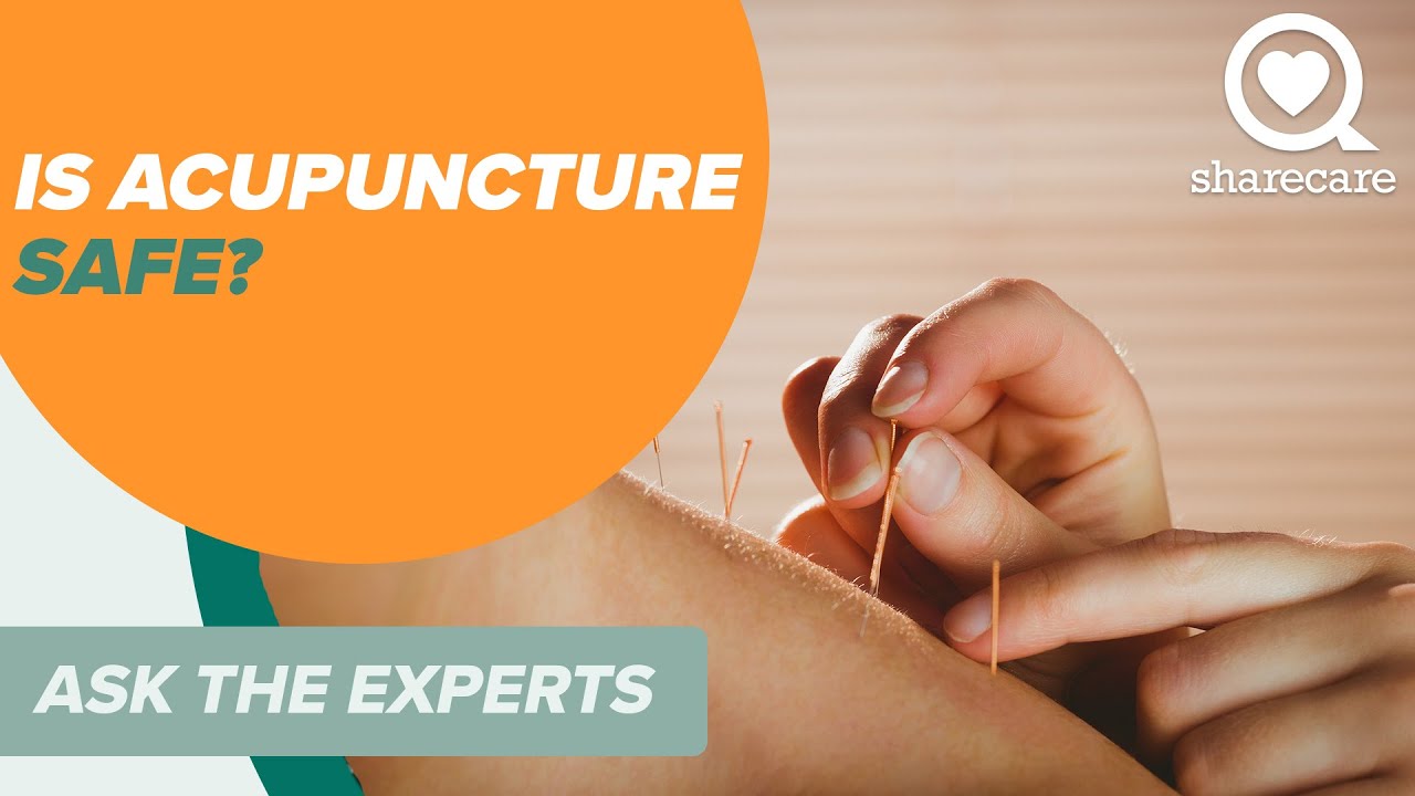 Is Acupuncture Safe? | Ask The Experts | Sharecare