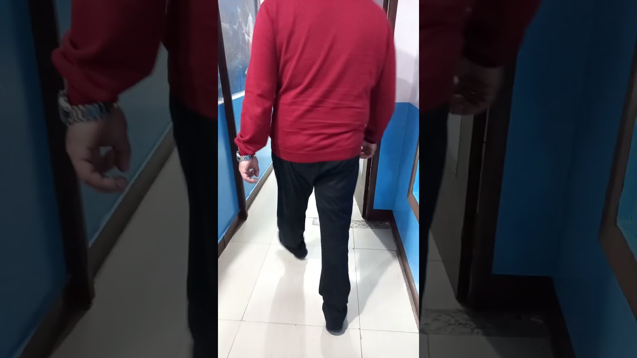 Walking  harmonious  Gait with Below Knee  Prosthesis with silicone lock liner system
