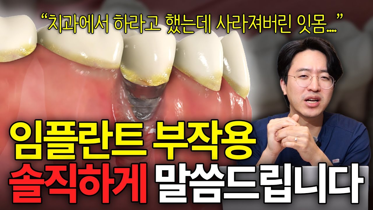 ”임플란트 하는데 왜 부작용이 있어요…” l 임플란트 신중하게 결정해야하는 이유