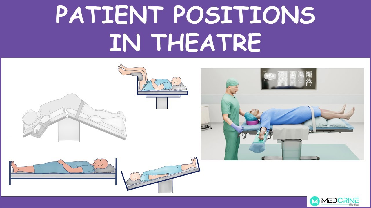 Patient positions and positioning in an operating theater