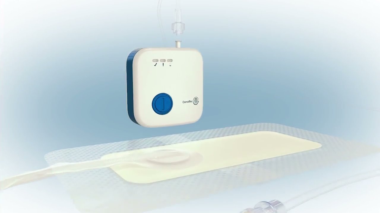 Avelle Negative Pressure Wound Therapy System application and removal - a knee surgery