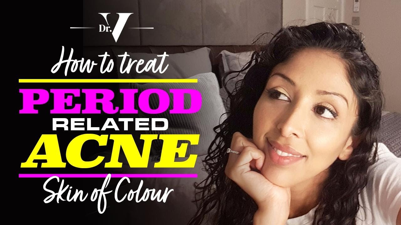 Dr V - How To Treat Period Related Acne for Skin of Colour | Brown/ Black skin | Skin of colour |