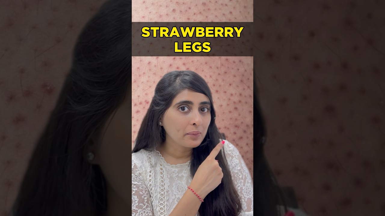 How to get rid of strawberry legs | How to remove strawberry legs | How to avoid  strawberry legs
