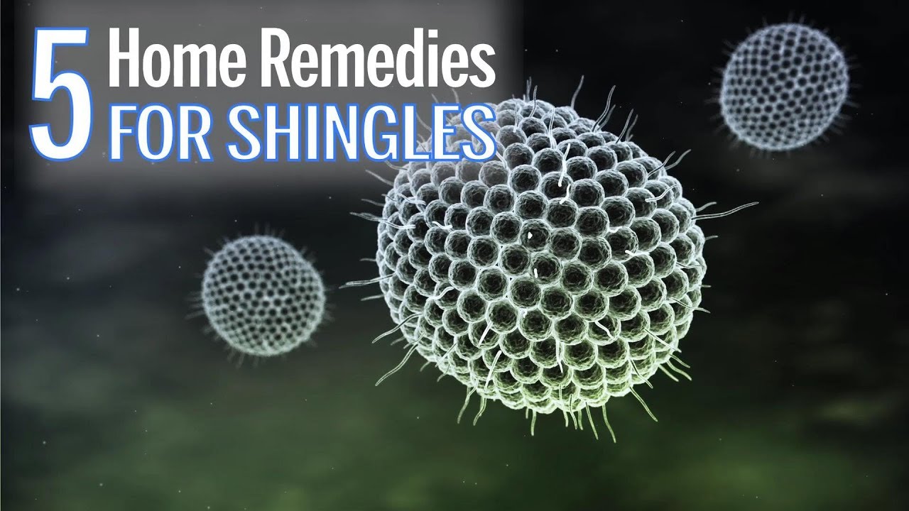 5 Home Remedies for Shingles | Health