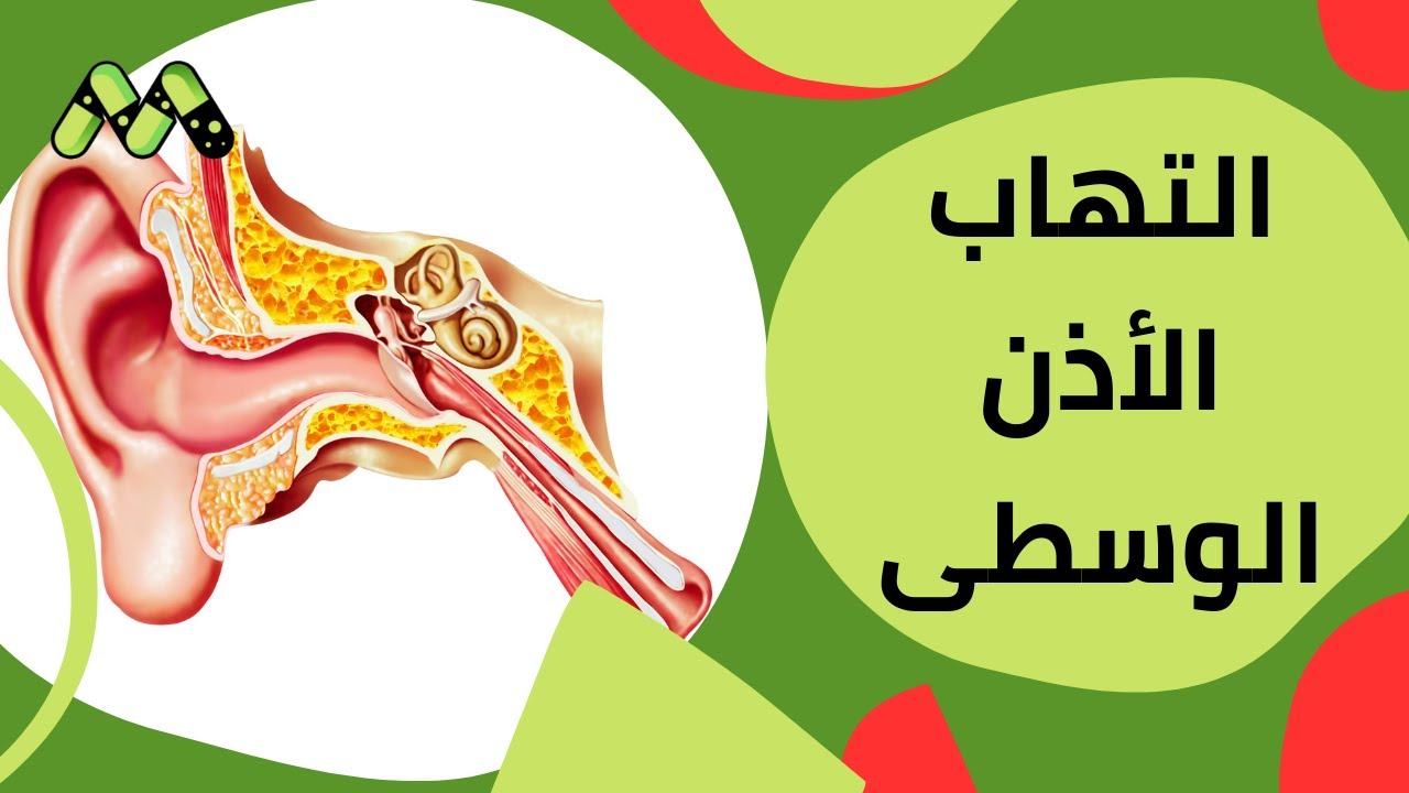 فيروس أ والعقد اللمفاوية والتهاب الأذن الوسطى فيروسات قد تصيب الأطفال تعرف على الأسباب