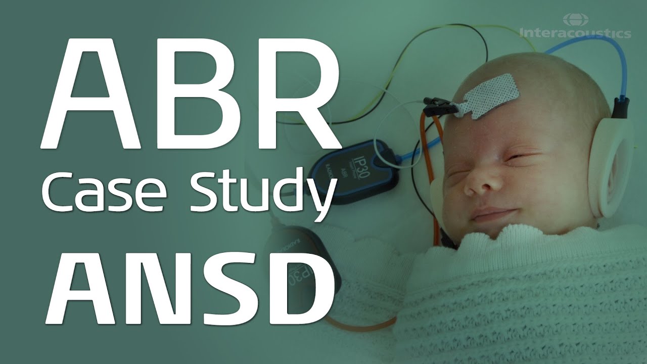 ABR Case Study: ANSD