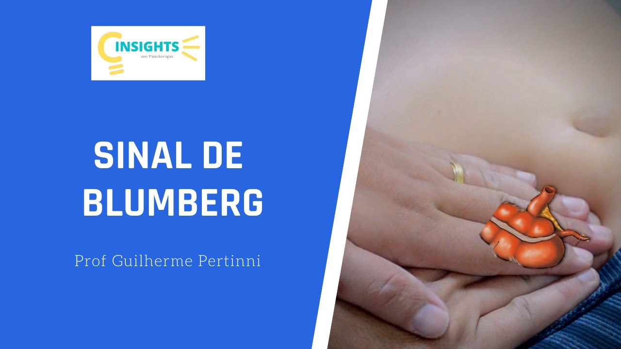 Como realizar a manobra de Blumberg e localizar o ponto de McBurney.#blumberg #mcburney #Semiologia