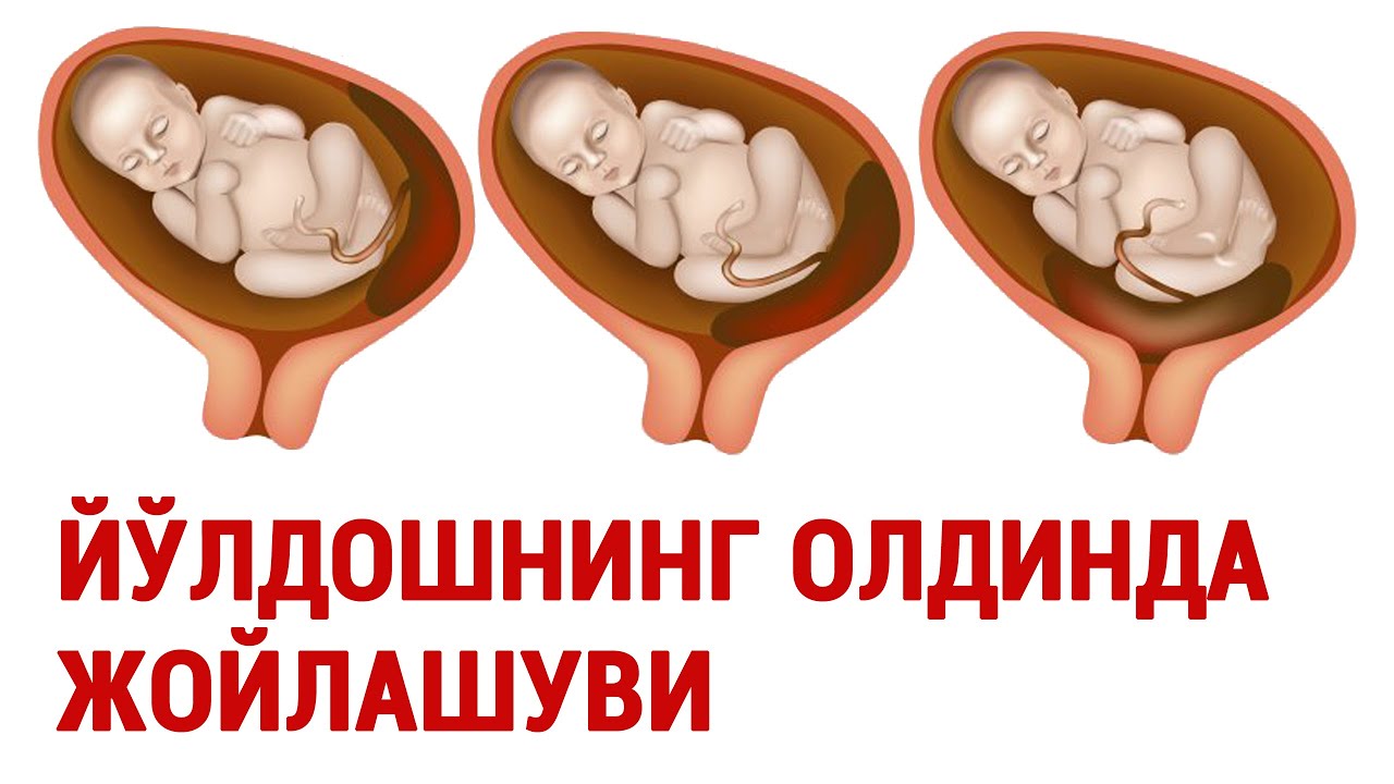 Йўлдошнинг олдинда келиши #doctorYakubjonov