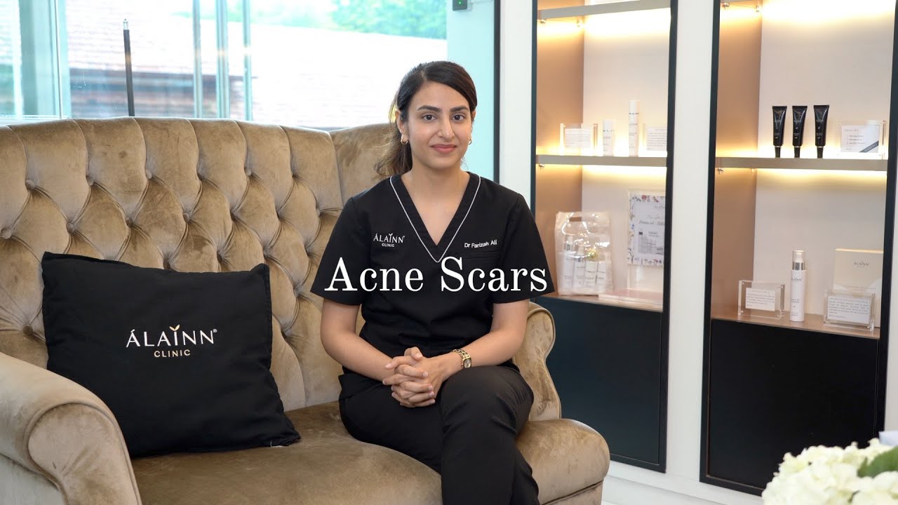 Acne Scars