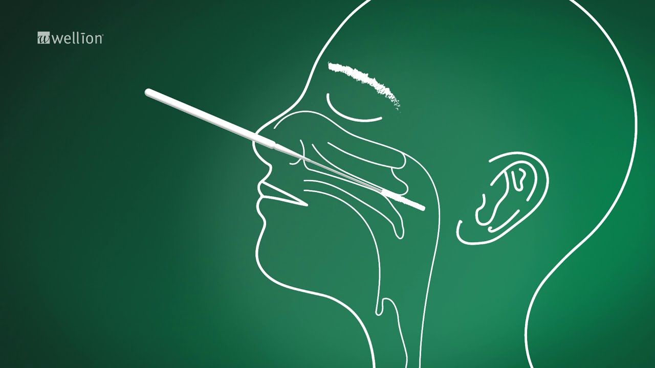 SARS-CoV-2 Ag Antigen RapidTest Nasopharyngeal swab / Schnelltest Nasen-Rachen-Abstrich
