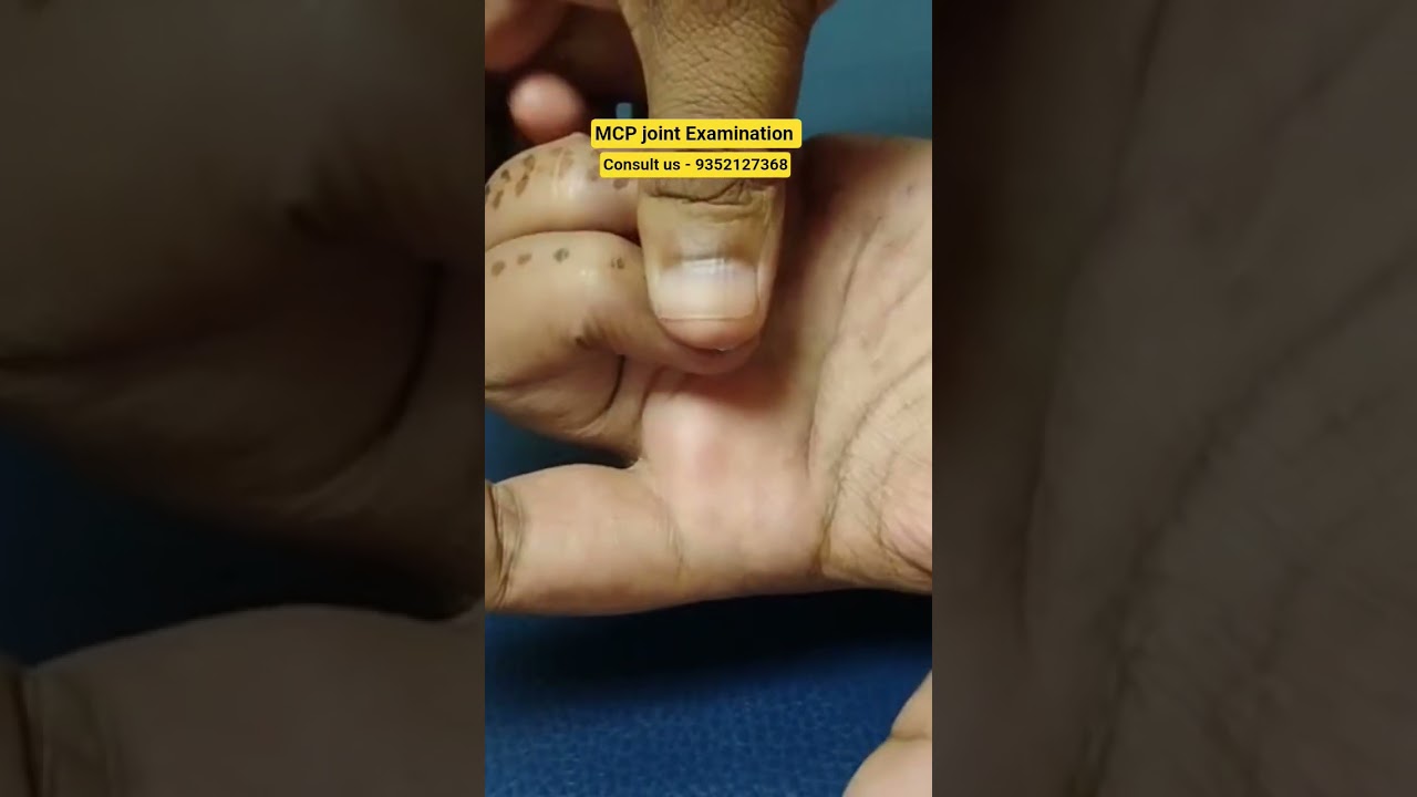 MCP joint Examination #physiotherapy #stiffness #pain #joints #finger #capsulotomy #movement #wax