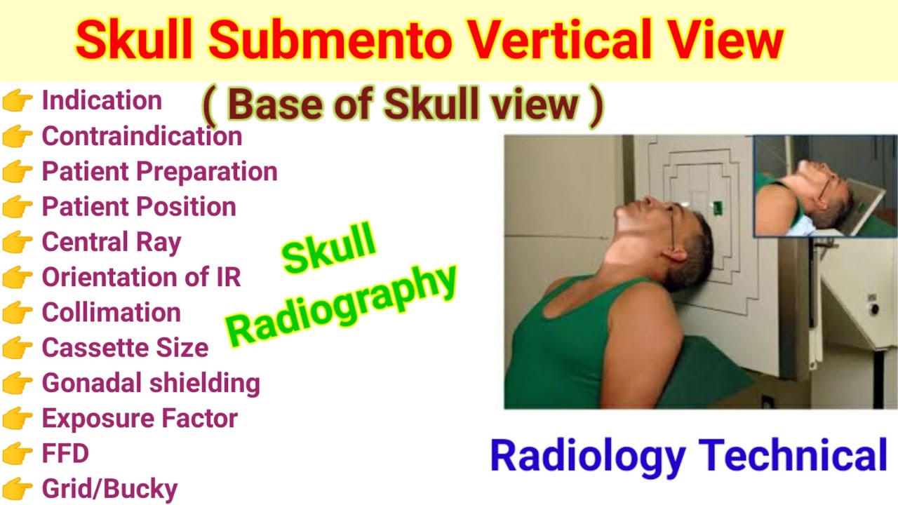 Skull Submento vartical View #Base of Skull View #in hindi # Skull Radiography #