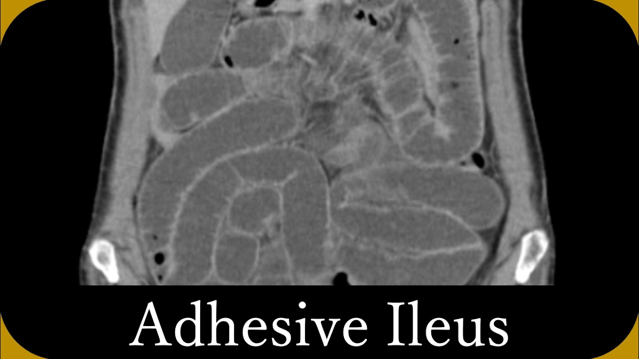 Imaging diagnosis of 