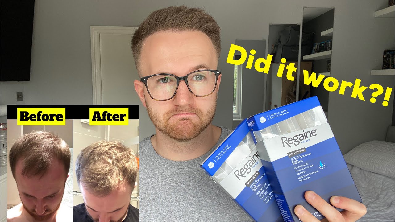 How to apply Regaine - hair loss talk for men