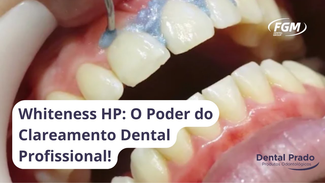 Guia Completo do Whiteness HP: Clareador Dental com Peróxido de Hidrogênio