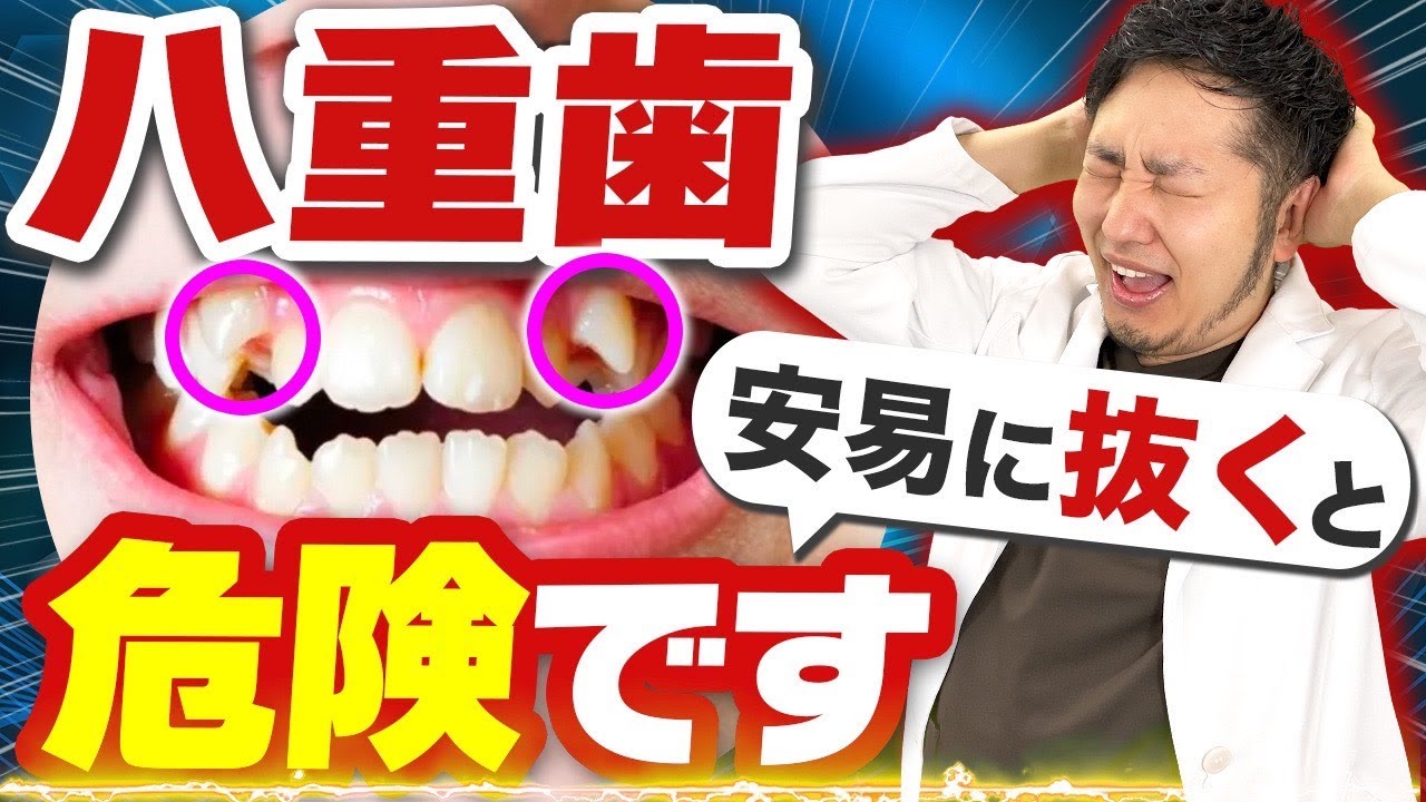 【八重歯】抜歯矯正するべき？治すメリットデメリットを歯医者さんが解説 #歯医者 #歯医者さん #矯正