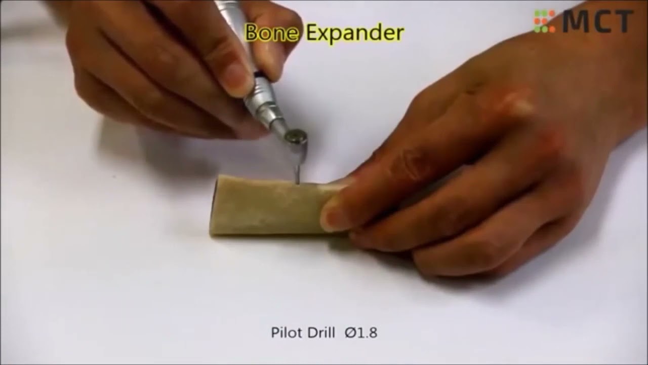 Bone Expander Kit for Ridge Splits