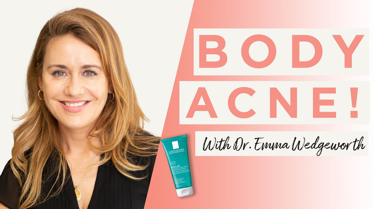 How To Prevent And Treat Body Acne | Dr Sam Bunting