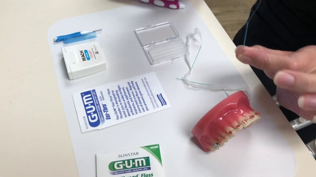 How to Take Care of Your Braces: Nirenblatt Orthodontics